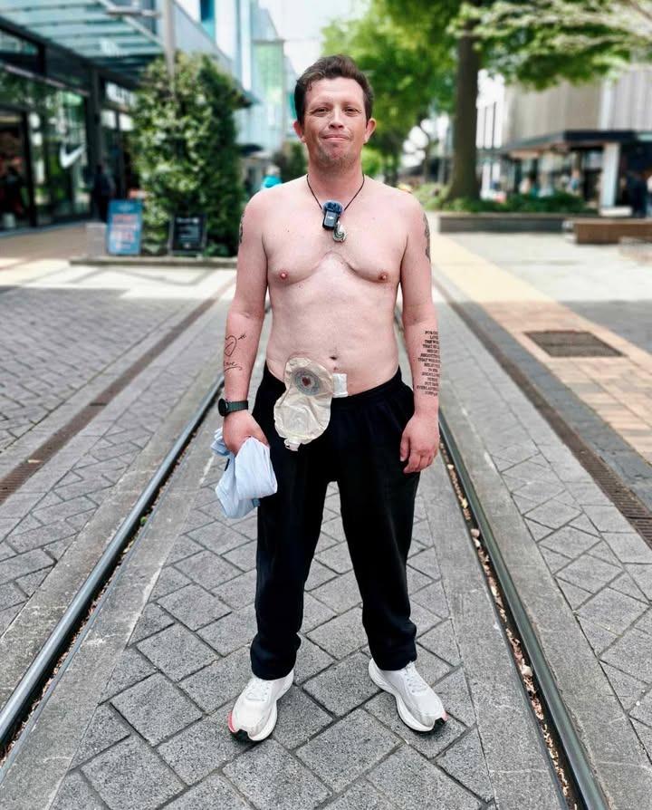 Jeremy Keen walked shirtless down Cashel St to spread awareness about living with a stoma. He had...