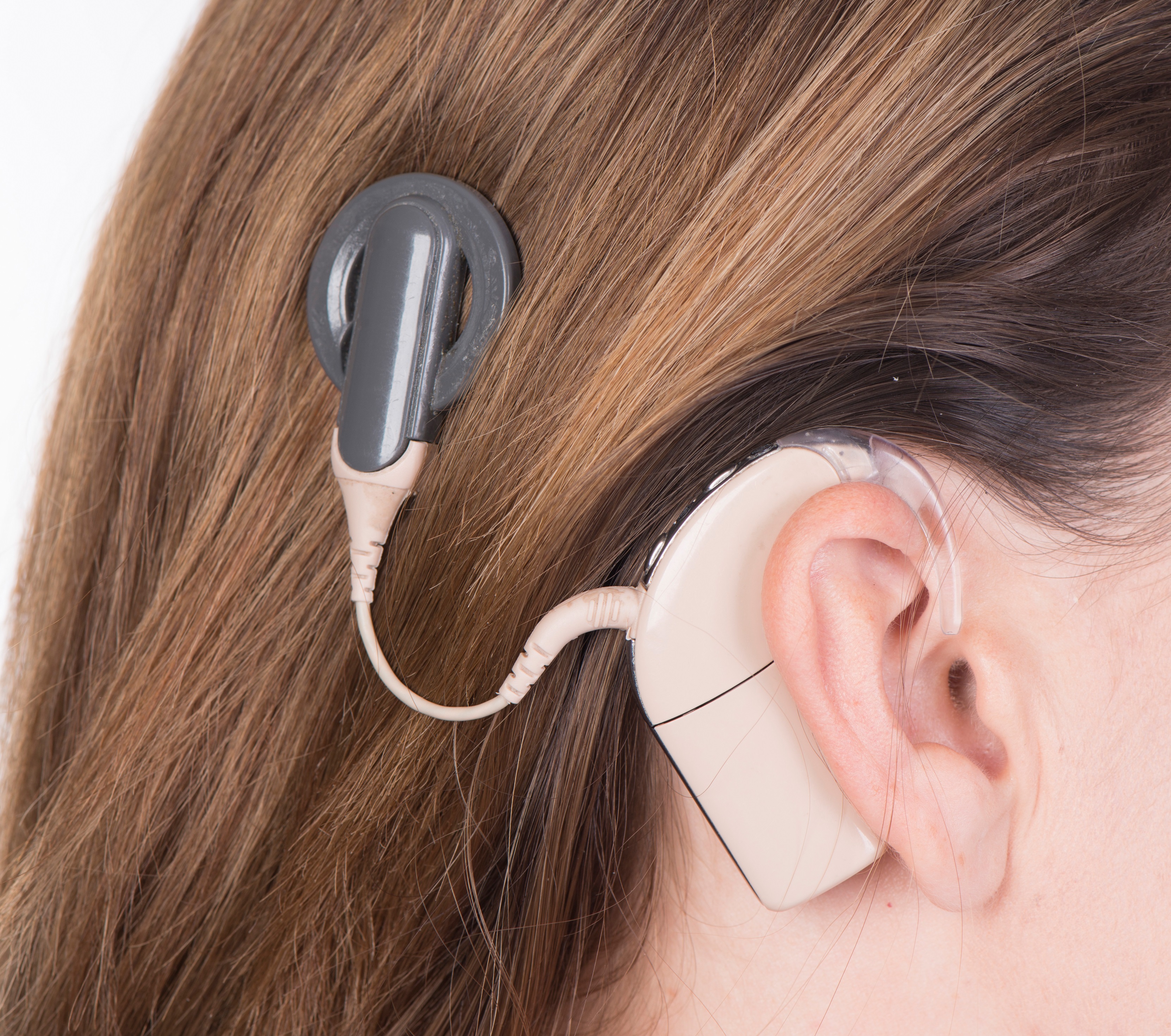 Ear hearing. Аппарат Cochlear кохлеарный. Слуховой аппарат кохлеарный имплант. Кохлеарный имплант Кохлер. Аппарат для глухих кохлеарная имплантация.