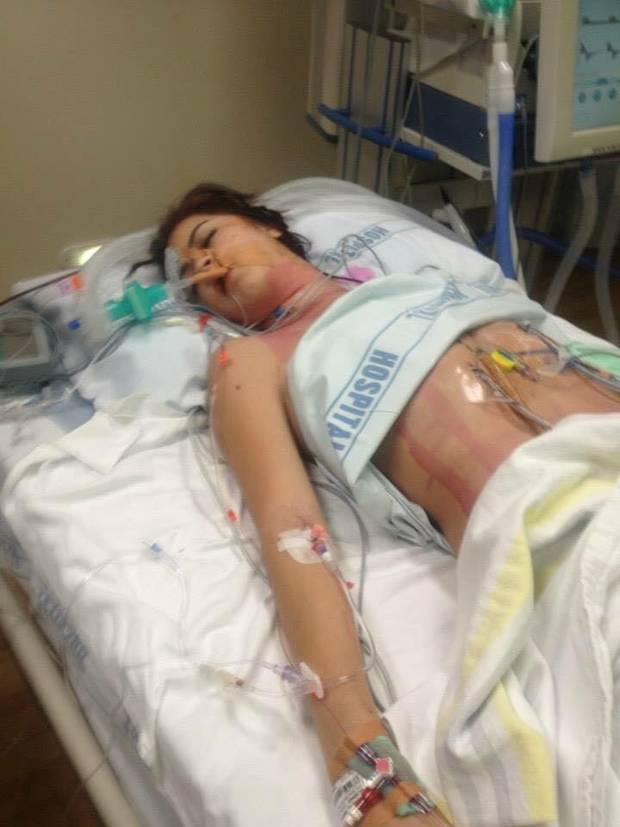 Jessica Davenport-Lee has had numerous surgeries on her heart and now needs a liver and heart...