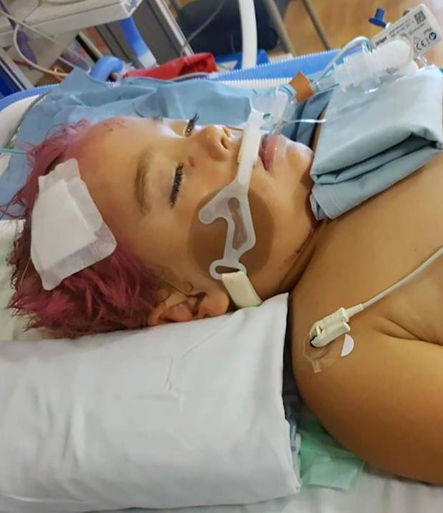 Little Fiazco Porter-Lewis in Whangarei Hospital after he was hit by a car in March. Photo: NZME