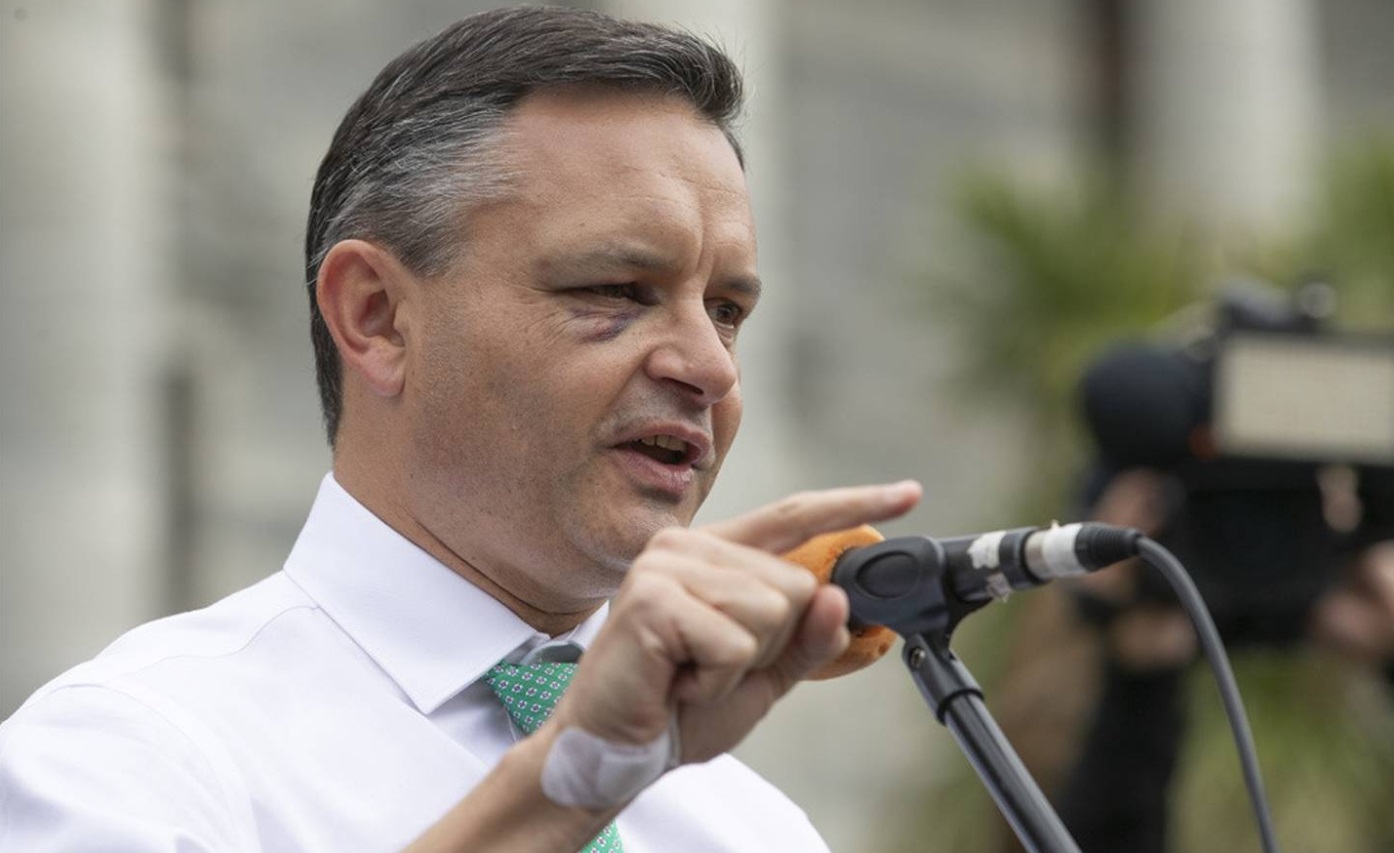 James Shaw speaks outside Parliament in Wellington in March, bearing signs of the assault. Photo:...