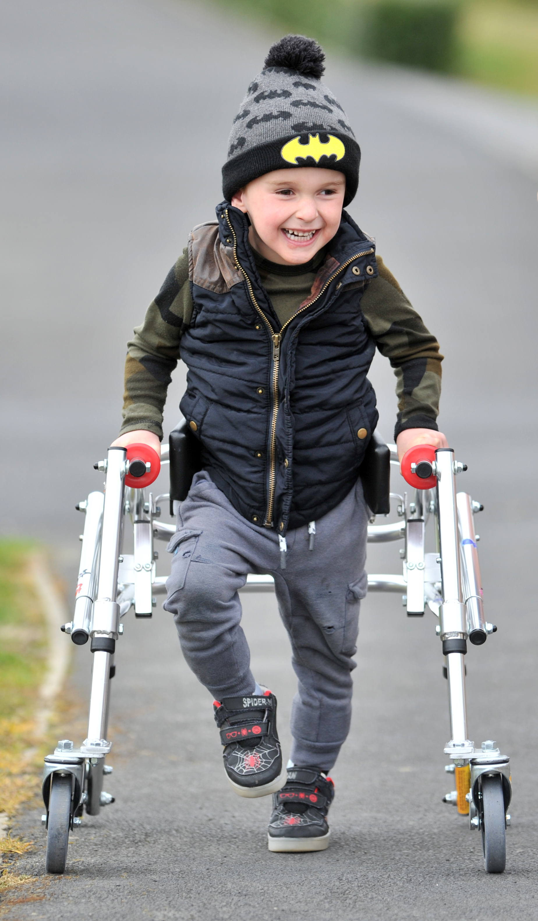 Harry Finch is upright and walking with a frame, just three months after major spine surgery in...