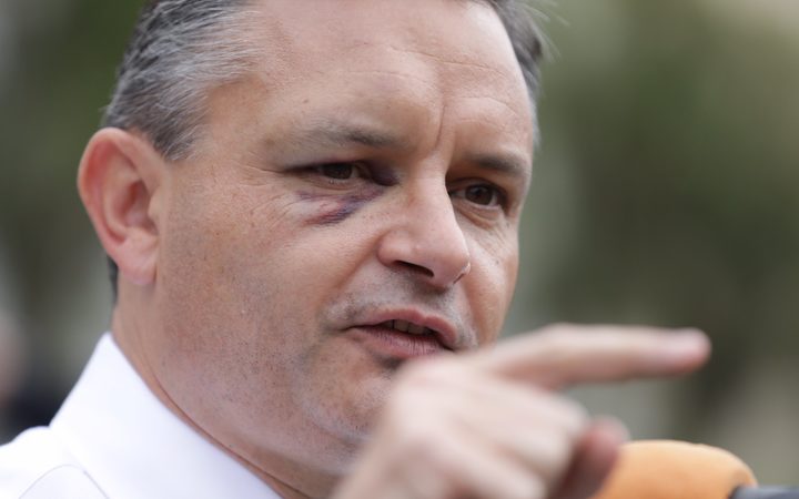 James Shaw appeared with a black eye at a climate change strike in Wellington following the...