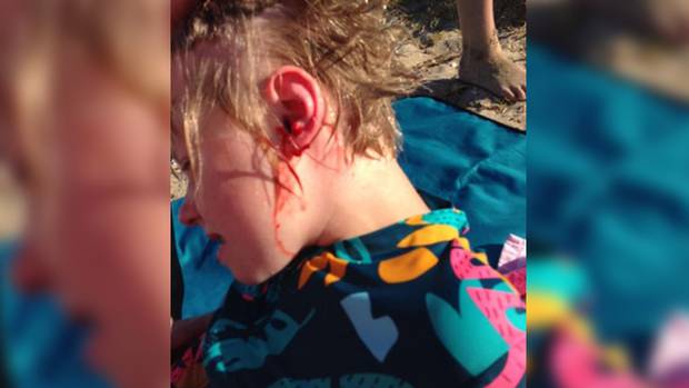 Nine-year-old Christiana Holt was taken to hospital after a dog attacked her on Eastern Beach on...