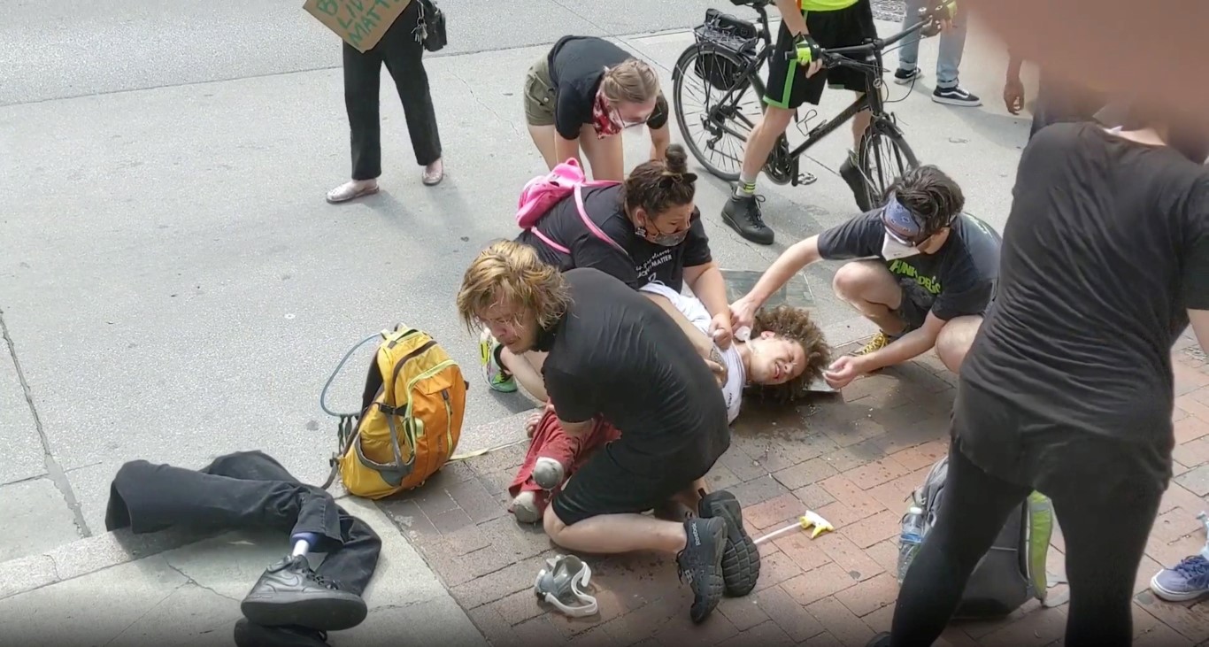 A double amputee, with his prosthetic legs by his side, receives assistance as he lies on the...