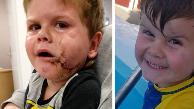Maxin Bennett immediately after (left) and shortly before the attack. Photos: Supplied via NZ Herald