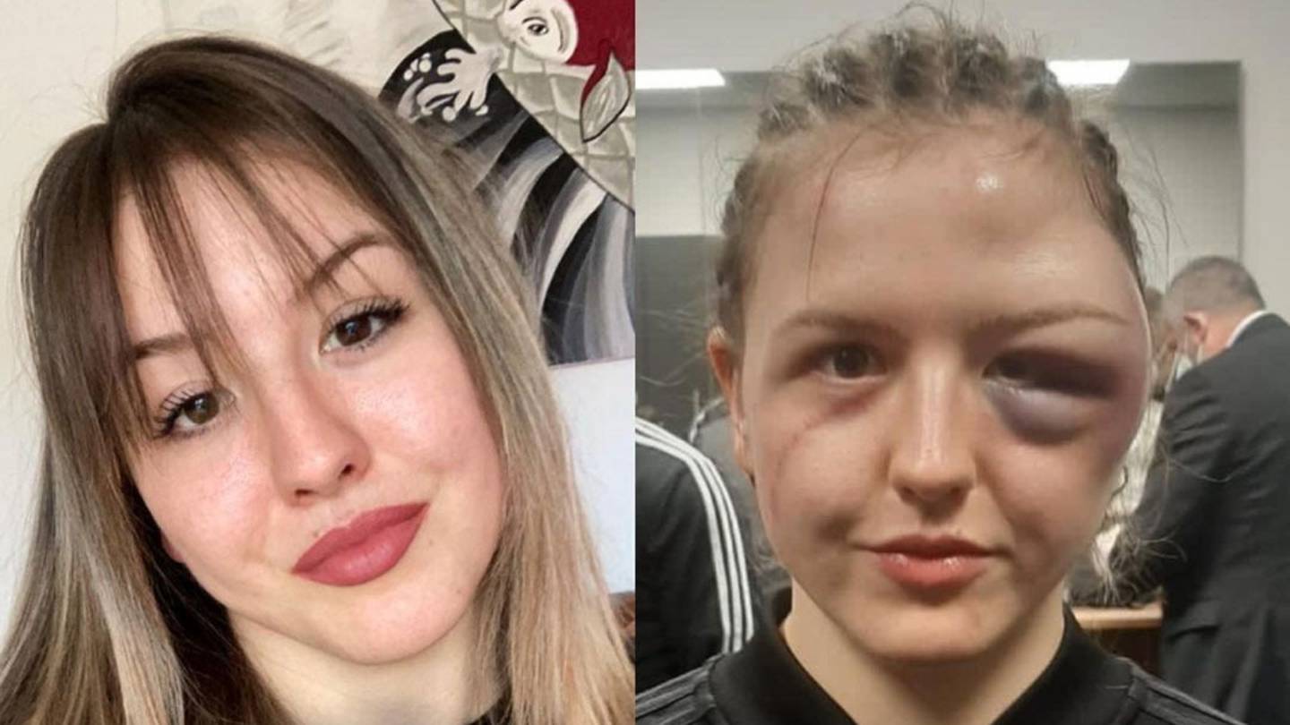 Before and after Cheyenne Hanson's victory. Photo: Instagram @cheyenne_hanson_boxing