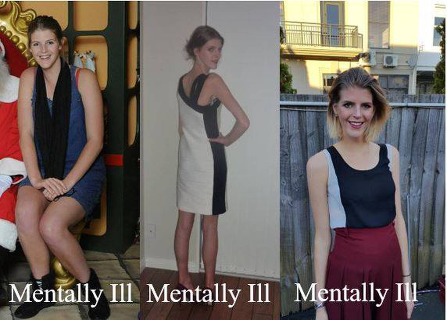 A photo Nelis posted to show her at the stages of her illness. Photo: Supplied via NZH