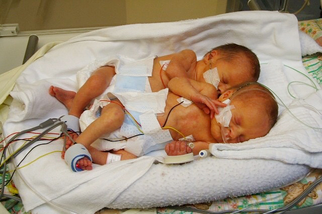 Babies in the Neonatal Intensive Care Unit at Christchurch Hospital. Photo: CDHB