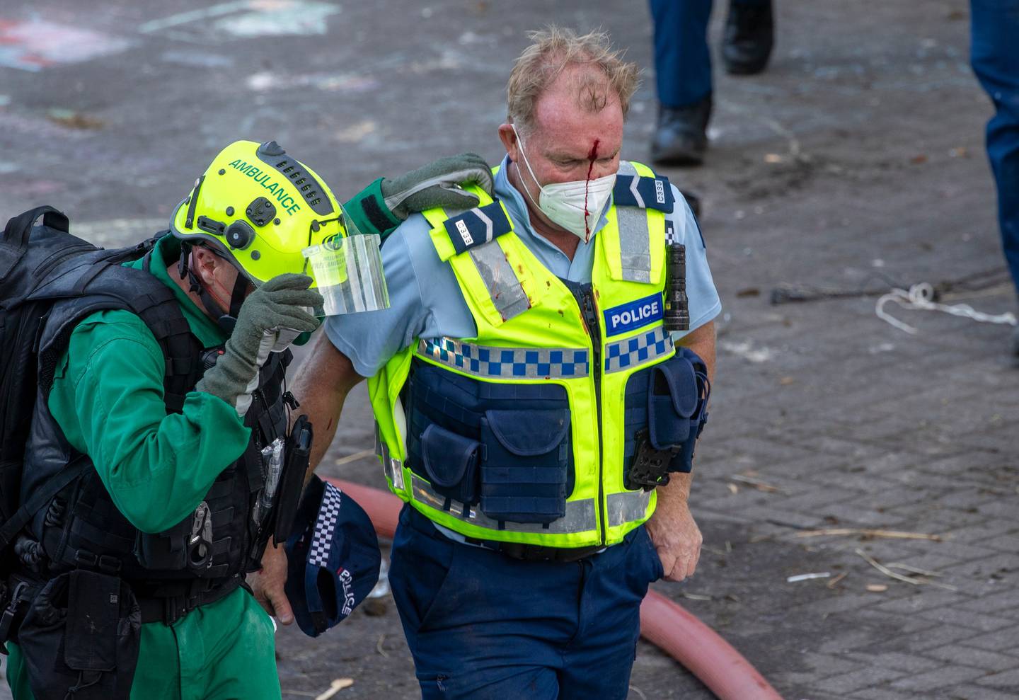 An injured officer is assisted by paramedics. Around 40 police officers were injured that day....