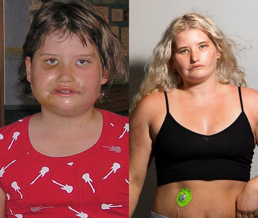 "I was bullied all of my schooling life, and up until the picture on left (11/12 years old) it...