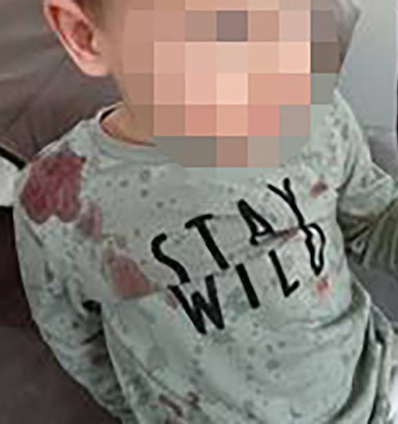 The toddler covered in blood following the May attack. His attacker has offered the victim $250....