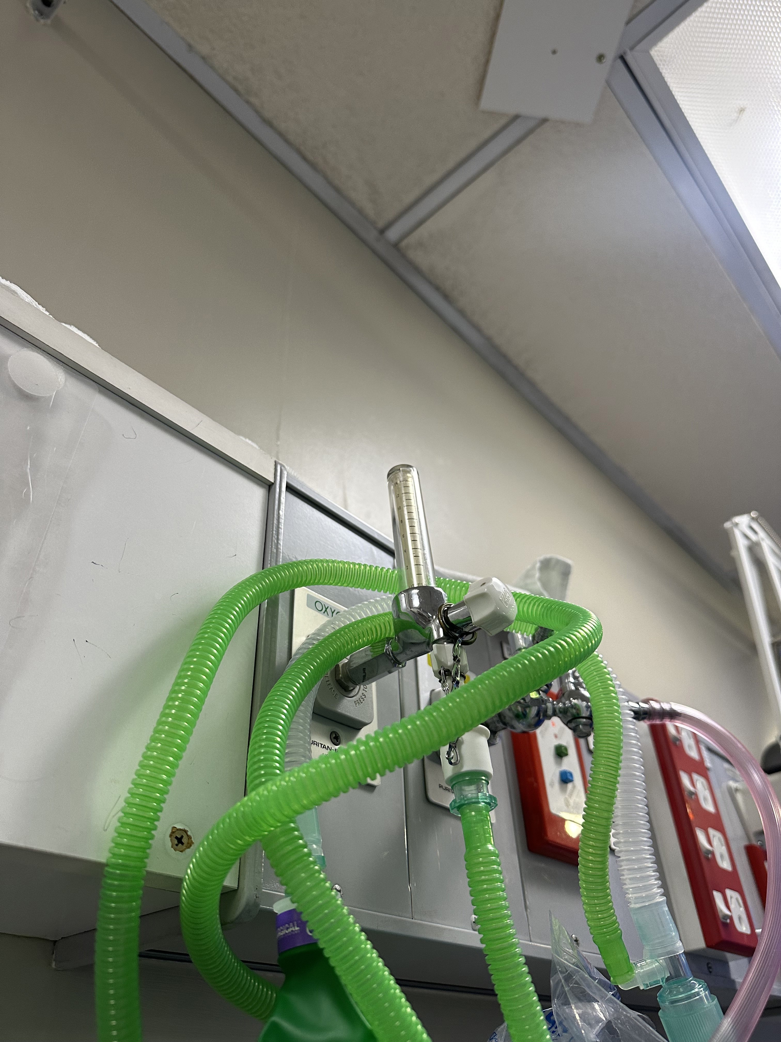 Leaks within the current Dunedin hospital. PHOTO: ODT FILES
