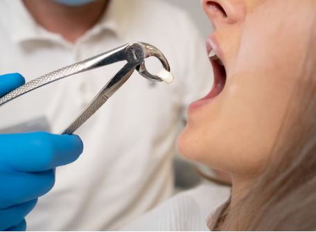 A woman was left in agony during the extraction of a wisdom tooth. The dental surgeon responsible...