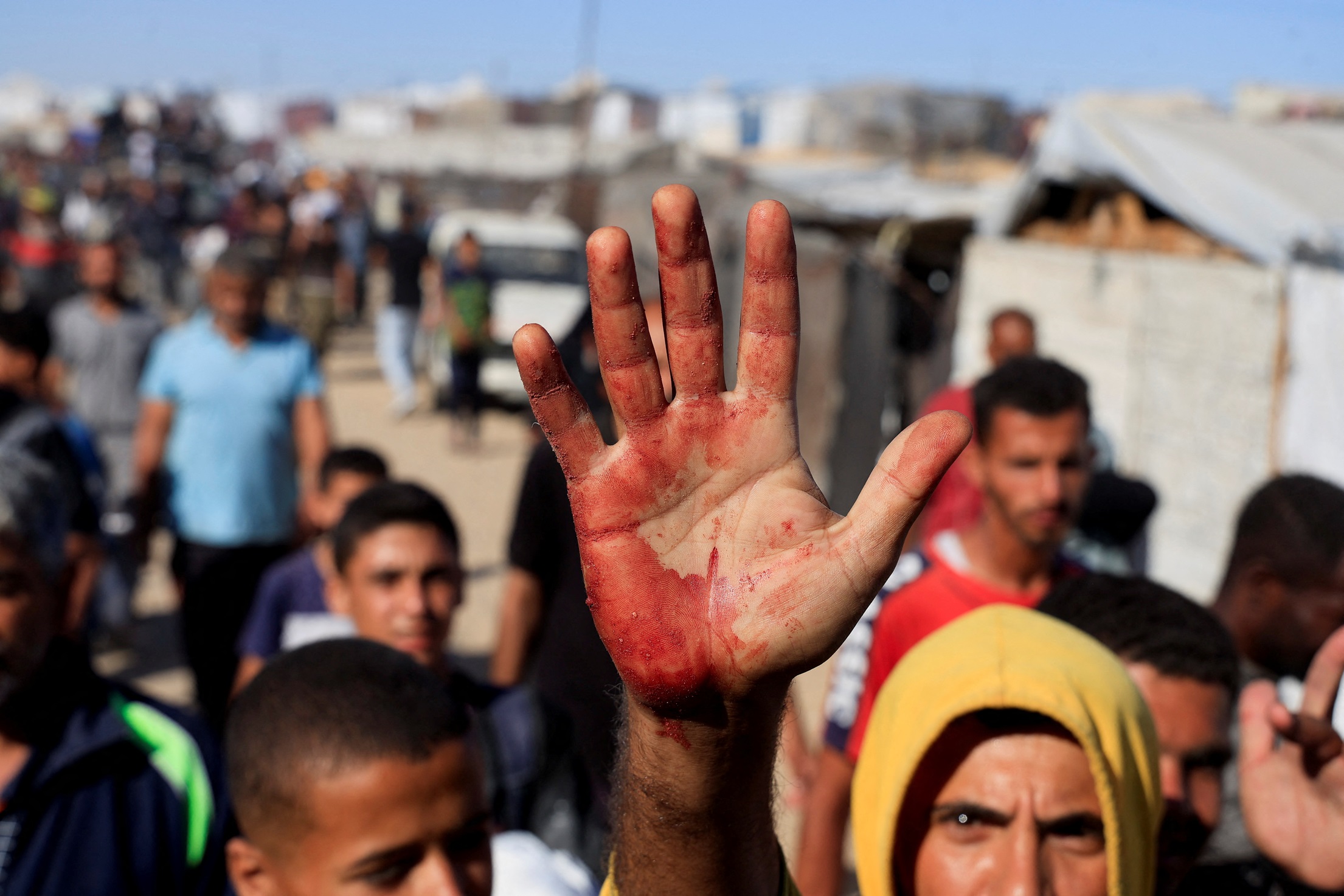 A Palestinian man shows blood stains on his palm after carrying people hurt while seeking aid...