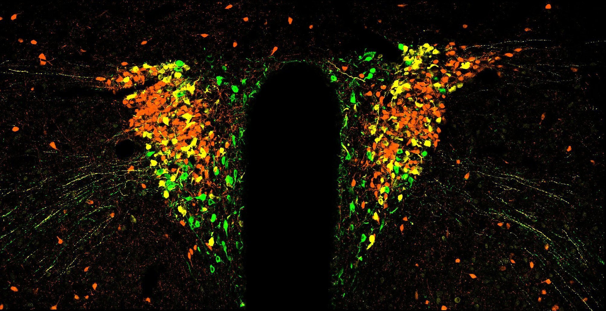 A region of a mouse brain, called the paraventricular nucleus of the hypothalamus, where stress...