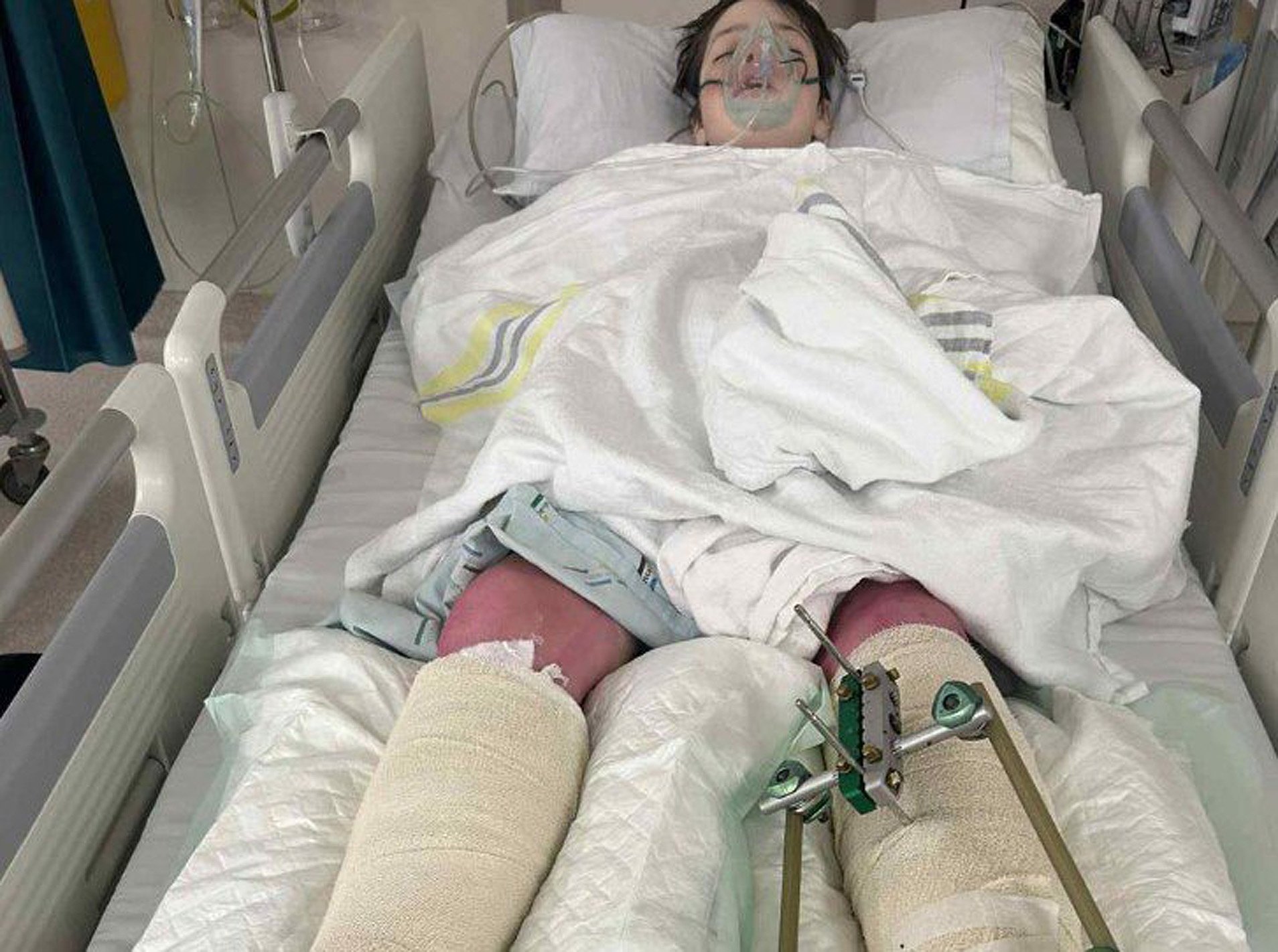 Charlie Lane, of Oamaru, was seriously injured in an 8m fall while skiing. Photo: supplied
