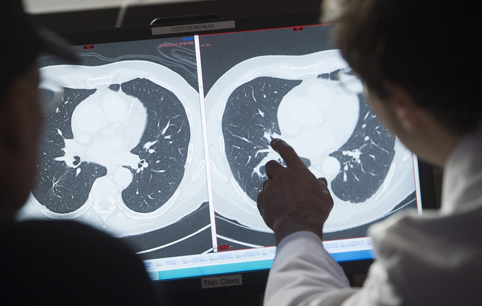 CT scans show an absence of cancerous tumors after T-cell therapy. Photo: TNS