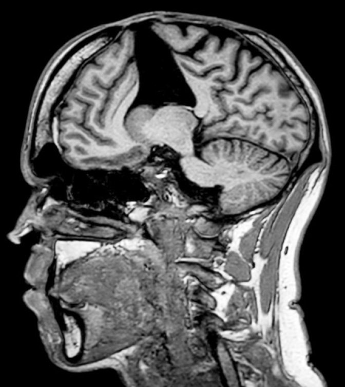A magnetic resonance image (MRI) shows the brain of a Dunedin Hospital patient who was recently...