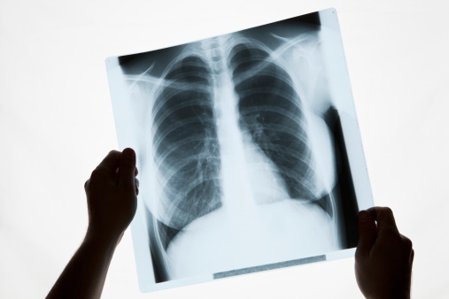 Publicy-funded X-ray services will be available in Wānaka from today. Photo: (File) Getty Images