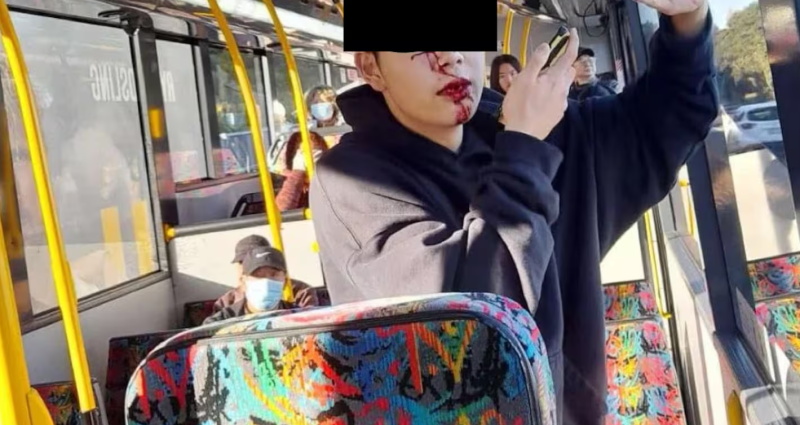 Jason directly after being attacked on the bus by Ioana Kariki in 2024. Photo: Open Justice