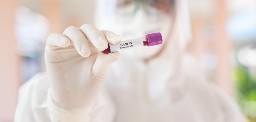 The Ministry of Health has requested that DHBs continue to ensure equitable access to testing for...