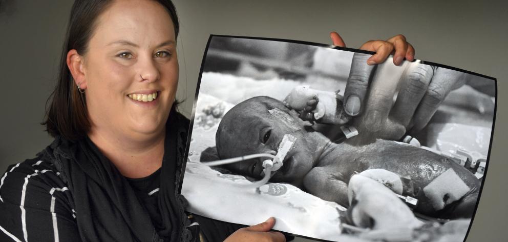 Kinley Wintrup, weighing just 590g, was the smallest baby to have survived in Dunedin to date...