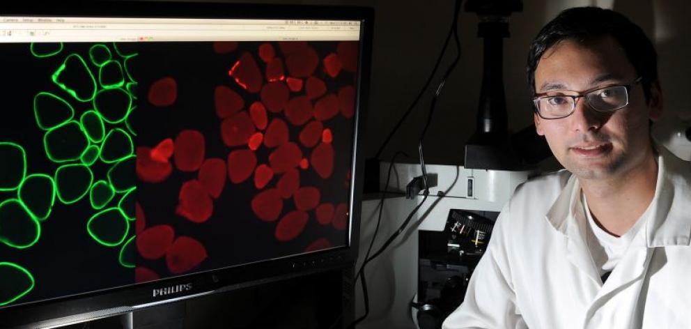 University of Otago master's degree student John Brady (22) examines  muscle cells, magnified about 200-fold, at the  university's physiology department. Photo by Craig Baxter.