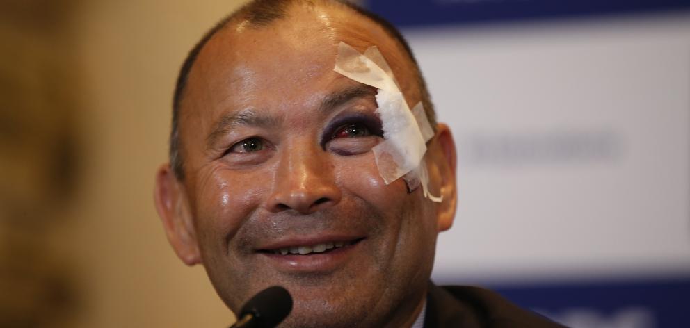 England head coach Eddie Jones speaks to the media during the RBS Six Nations media l. Photo:...