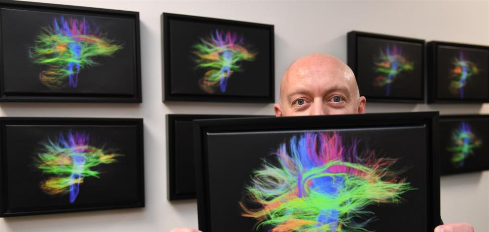 Dunedin Study data manager Antony Ambler holds a brain scan of a staff member involved in the cohort study. Photo: Stephen Jaquiery