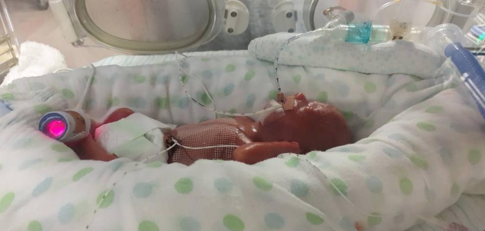 His twin brother Riley lost his fight for life at 16 days old. Photo / Supplied