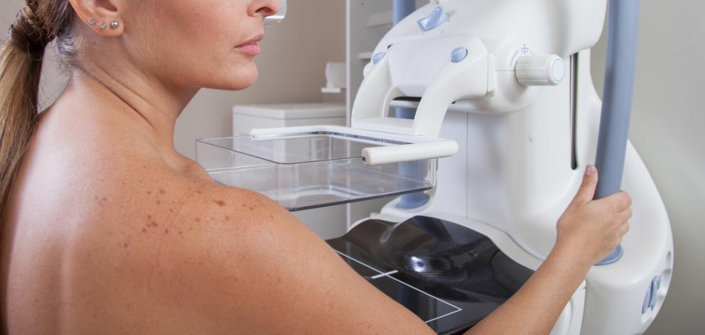 Mammogram appointment reminders were mistakingly sent to Auckland women. Photo: Getty