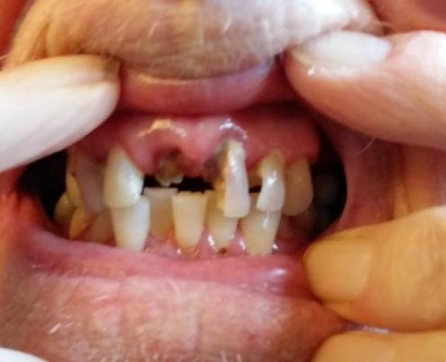 Resthome resident missing front teeth unnoticed by staff. Photo: RNZ