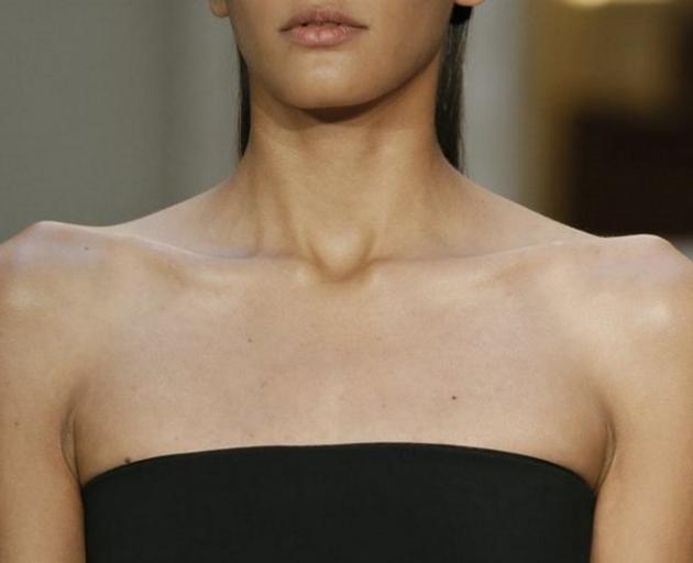France and Israel have banned excessive thinness in models. Photo: Reuters 