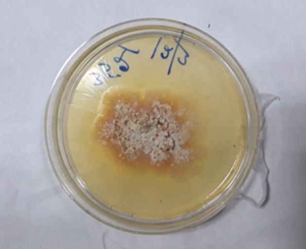 "Creamy pasty colony with buff coloured pigmentation". Photo: Medical Mycology Case Reports