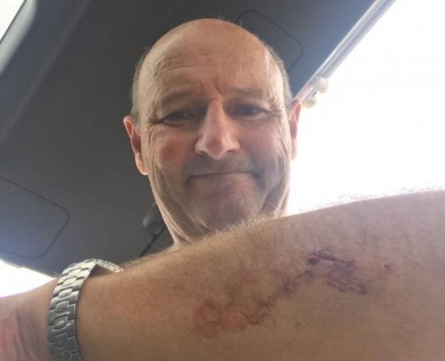 Takapuna resident Nick Minogue, 60, was attacked by what he believes was a Great White shark off...