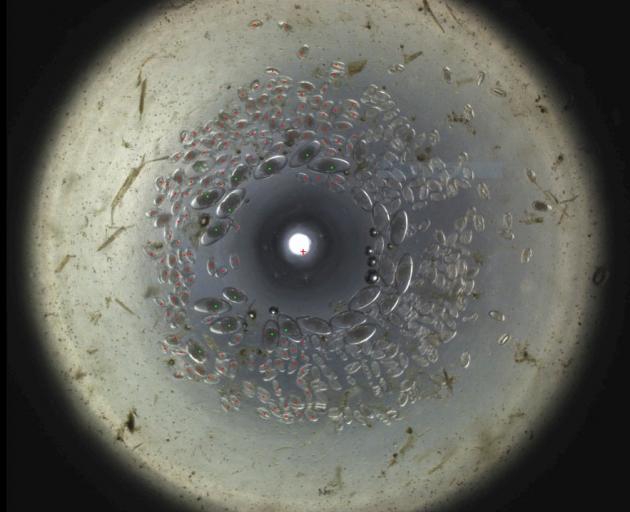 Sheep parasite eggs captured using Techion Group's FECPAK G2. PHOTO: TECHION GROUP
