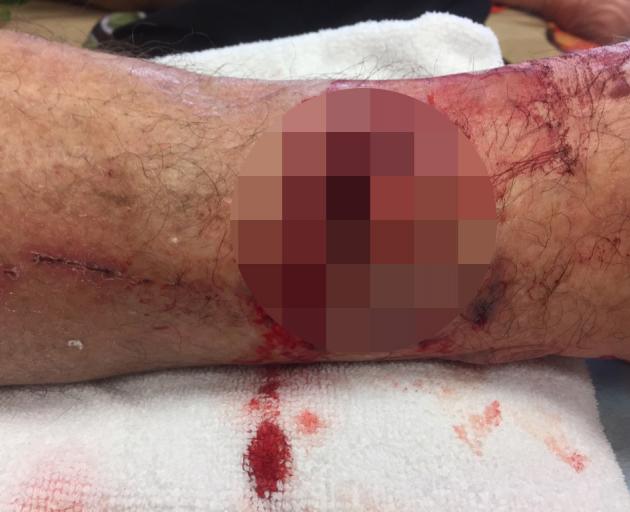 Mr Braid's leg on the day of the attack. Photo: Supplied