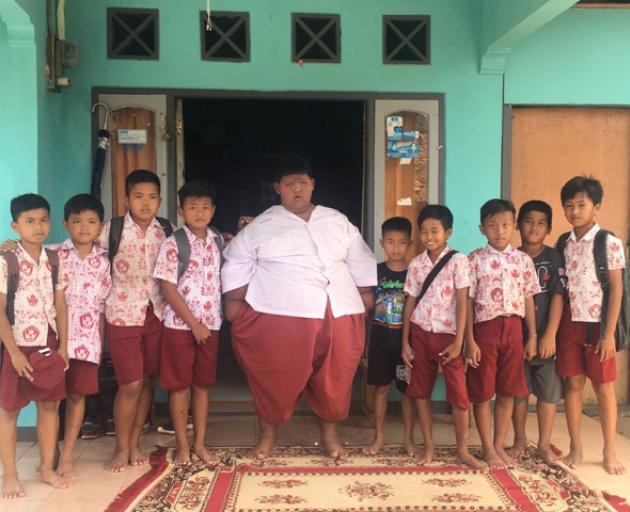 Arya Permana at school with his classmates in Karawang, West Java, Indonesia, before his surgery....