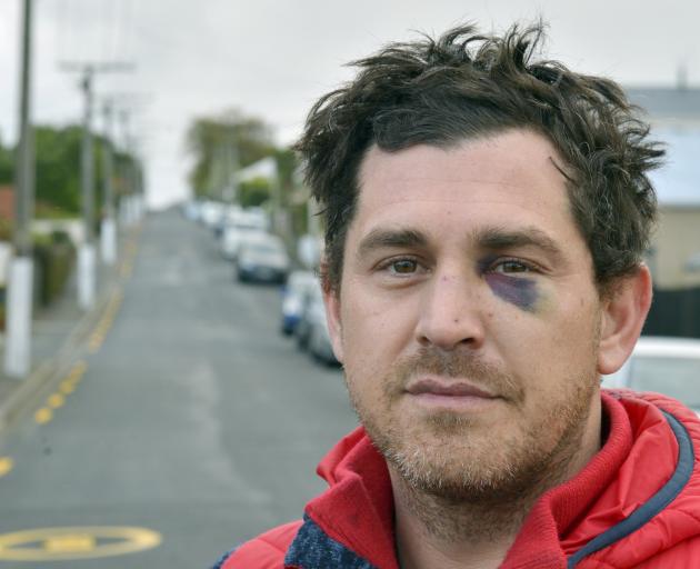 After moving back to Dunedin last year, Jared never thought he would be the victim of a violent assault in the city. Photo: Gerard O'Brien