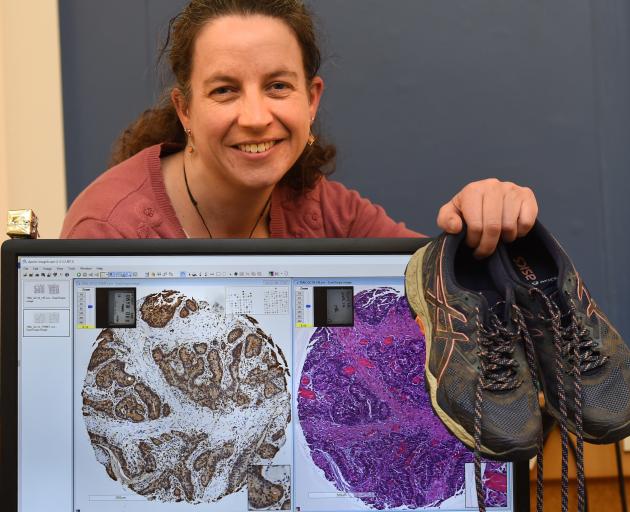 Dunedin Hospital oncologist Dr Sharon Pattison with her running shoes. Dr Pattison is preparing...