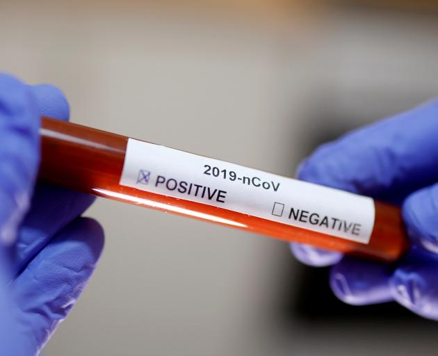 Kiwi Experiences Strange Covid 19 Symptoms Otago Daily Times Online News
