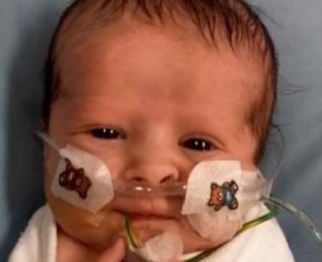 Keanu-Jay Brown was born with a rare life-threatening condition which means food goes into his...