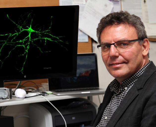 University of Otago School of Biomedical Sciences researcher Prof John Reynolds and his team have...