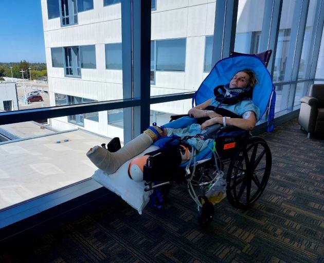 Anna Parsons lost her foot following the accident and faces a long road to recovery, but says her...
