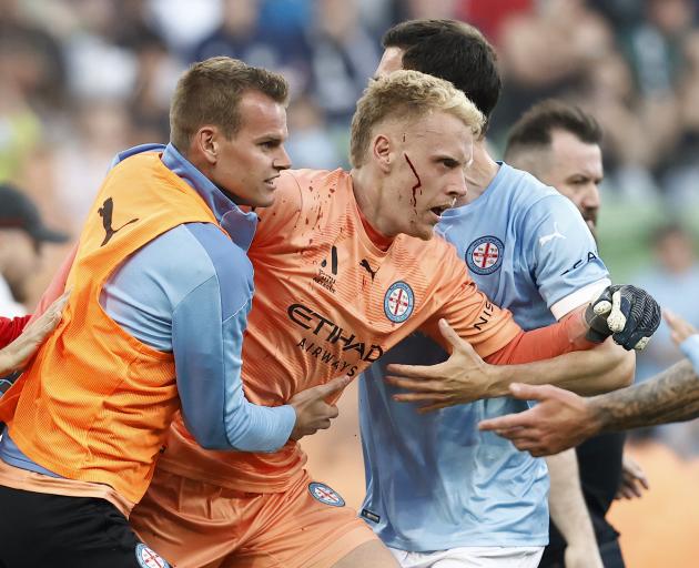 A bleeding Tom Glover of Melbourne City is escorted from the pitch by team mates. Photo: Getty...