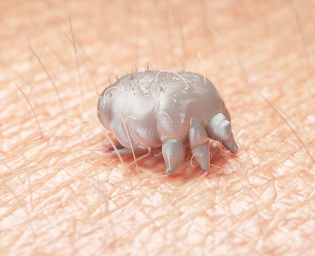 Dr Chambers said scabies can be a hard disease to diagnose as some don’t realise they are...