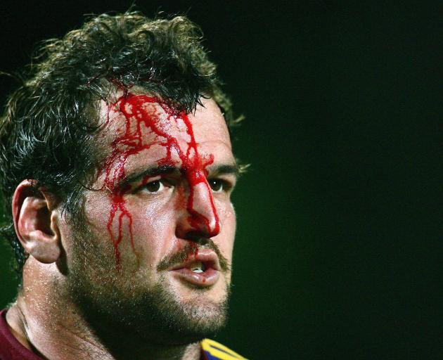 Hayman is among a group of former players trying to sue rugby authorities over head-related...