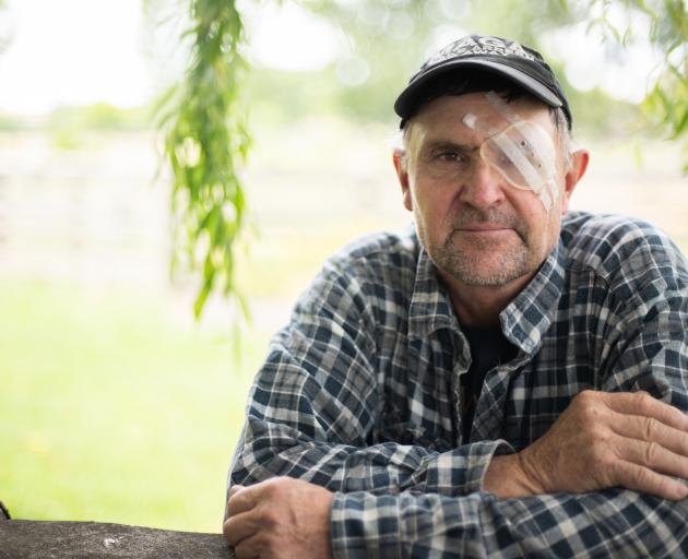 Alexandra resident Rob Anderson is recovering from his third cornea transplant due to a rare eye...