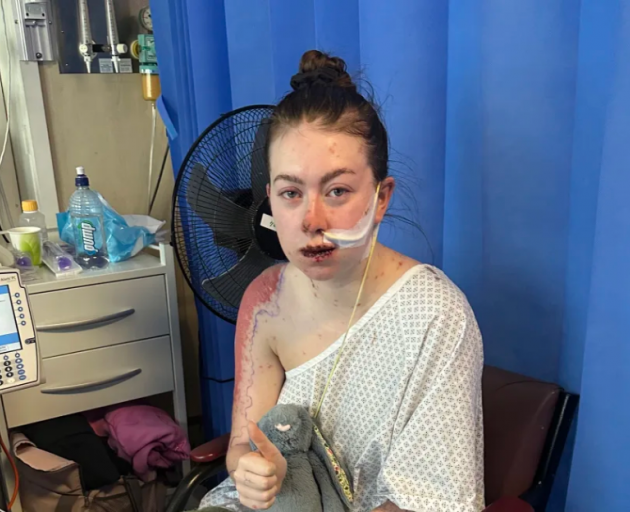 Charlotte spent 30 days in Palmerston North Hospital after the reaction. Photo: Supplied